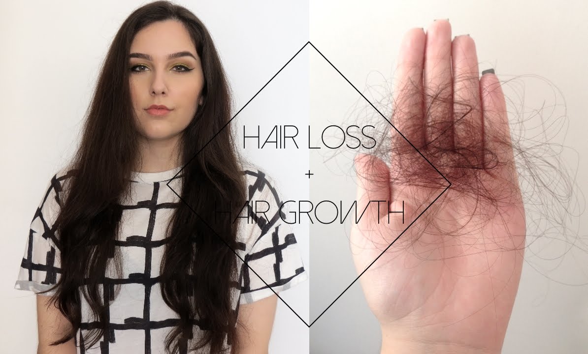 My Hair Loss Story + Hair Growth Tips