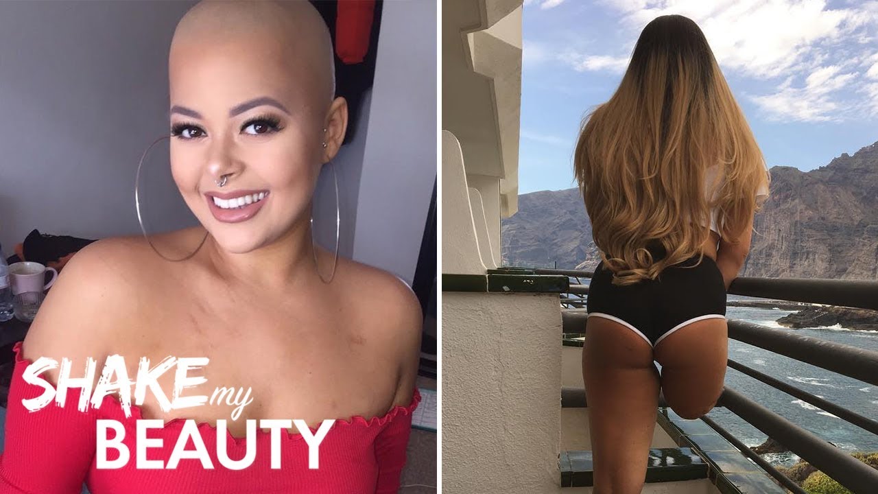 'Never Let Cancer Stop You From Looking Like A Snack’ | SHAKE MY BEAUTY