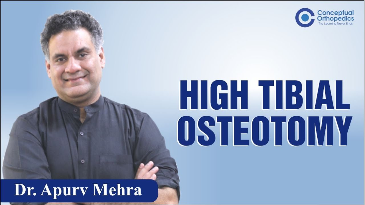 High Tibial Osteotomy by Dr. Apurv Mehra