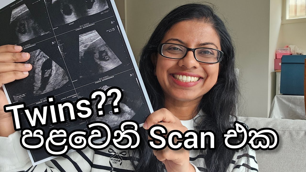 First Scan| ඔස්ට්‍රේලියාවෙ මගේ pregnancy journey එක