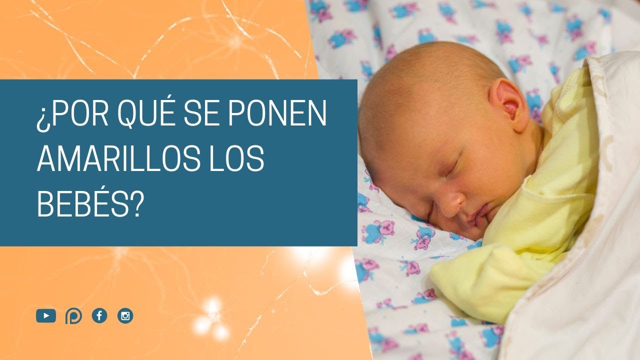 ¿Por qué se ponen amarillos los bebés?