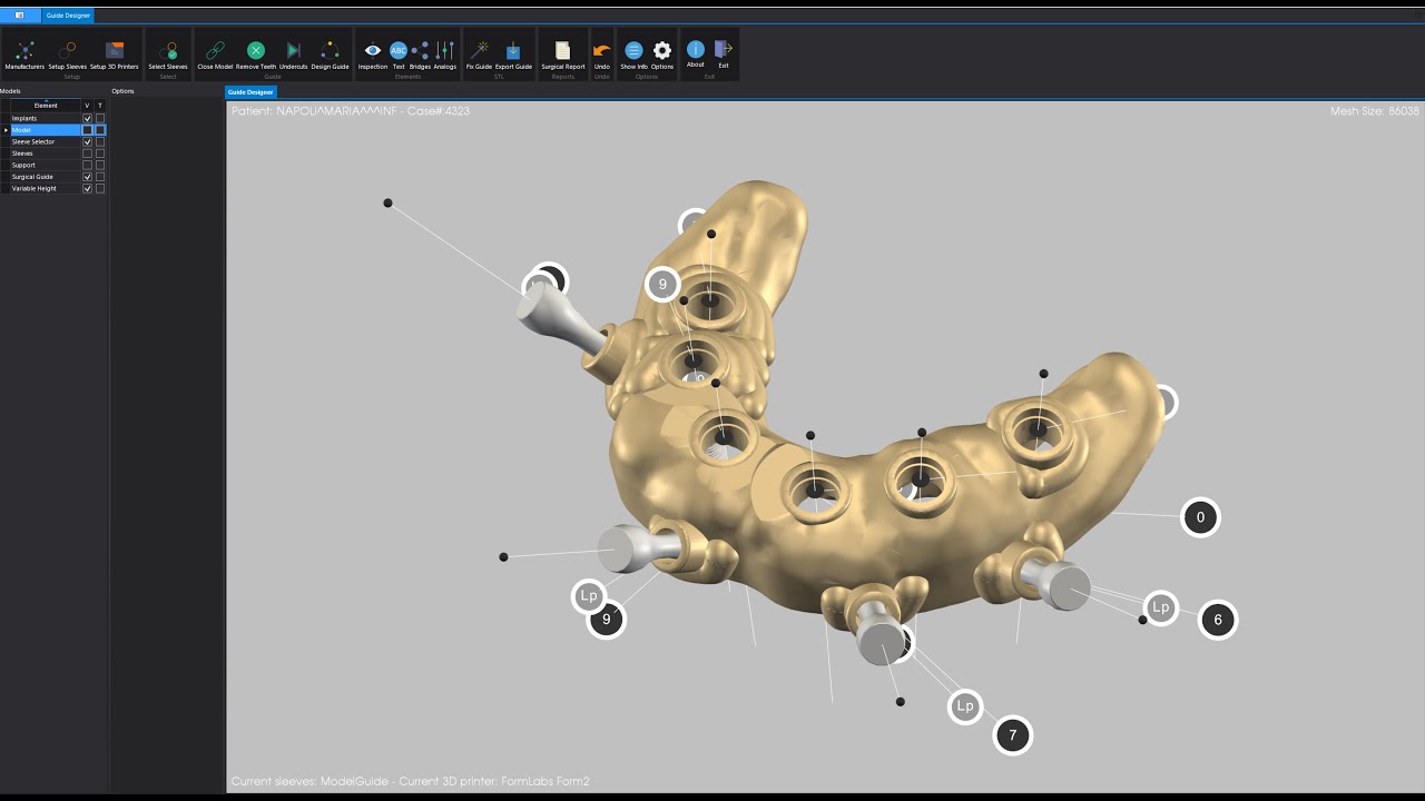 3°Lezione Webinar Implant 3D: Creazione Guida Chirurgica