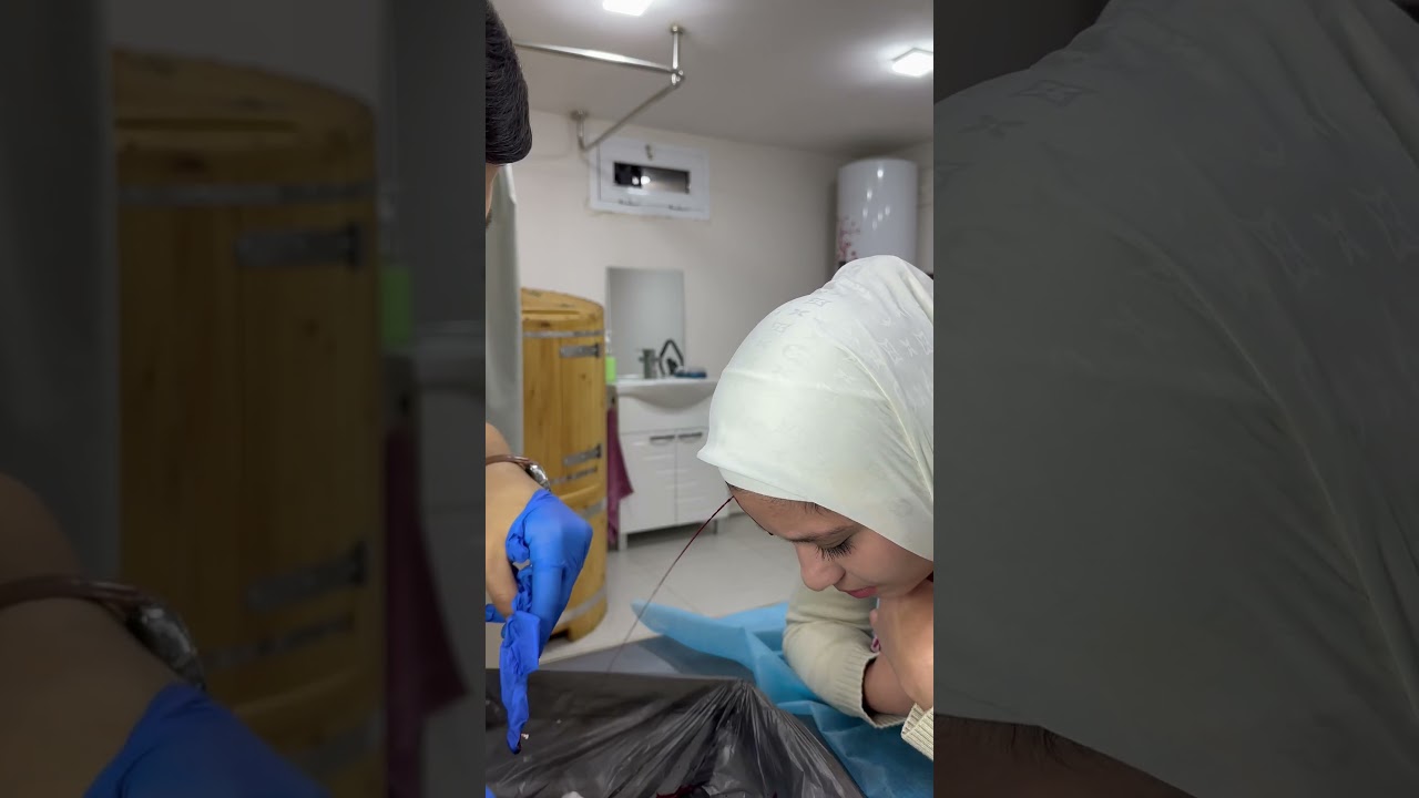 Bosh og&rsquo;rg&rsquo;iga chertma hijoma. Бош оғрғига чертма хижома. +99891-565-14-41 #hijama #shortsvideo