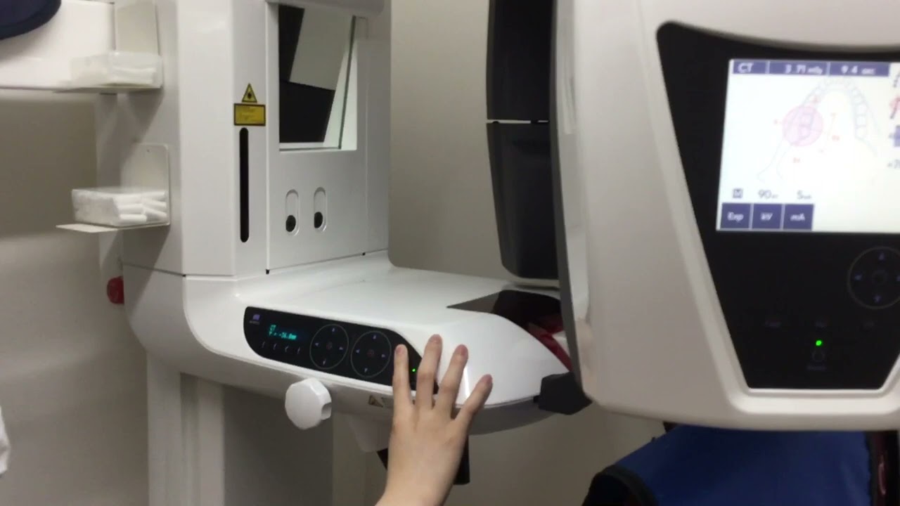 CT  パノラマスカウト　埋伏用　エンド用