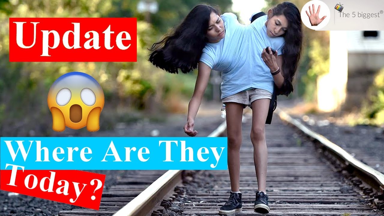 Conjoined Twins Carmen and Lupita's : 2 legs and 4 arms! Update Video! ~Body Bizarre!