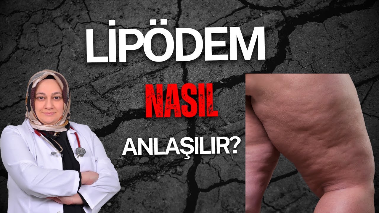 Lipödem Nasıl Anlaşılır?