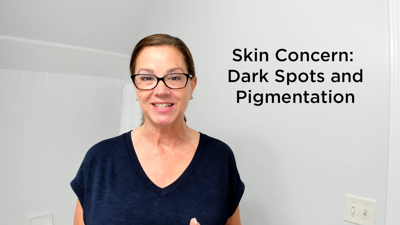 Skin Concern: Dark Spots and Pigmentation