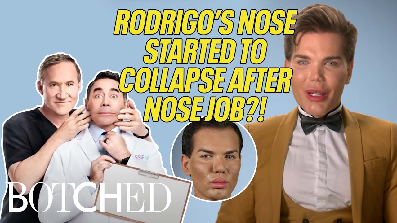 Rodrigo is BACK After Doctors Reject Him With a Botched Nose Job | Botched | E!