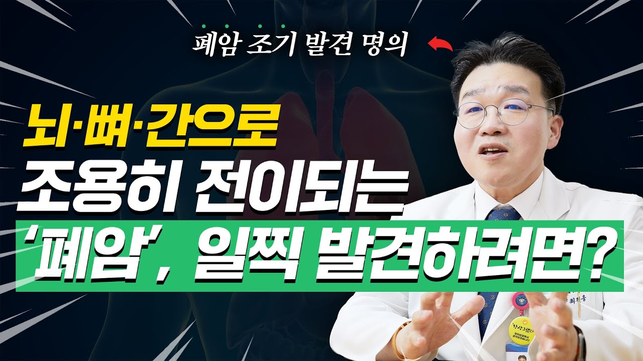 [폐암 조기 발견 명의]비흡연자 폐암 늘어&hellip; '이것'으로 조기 발견 가능