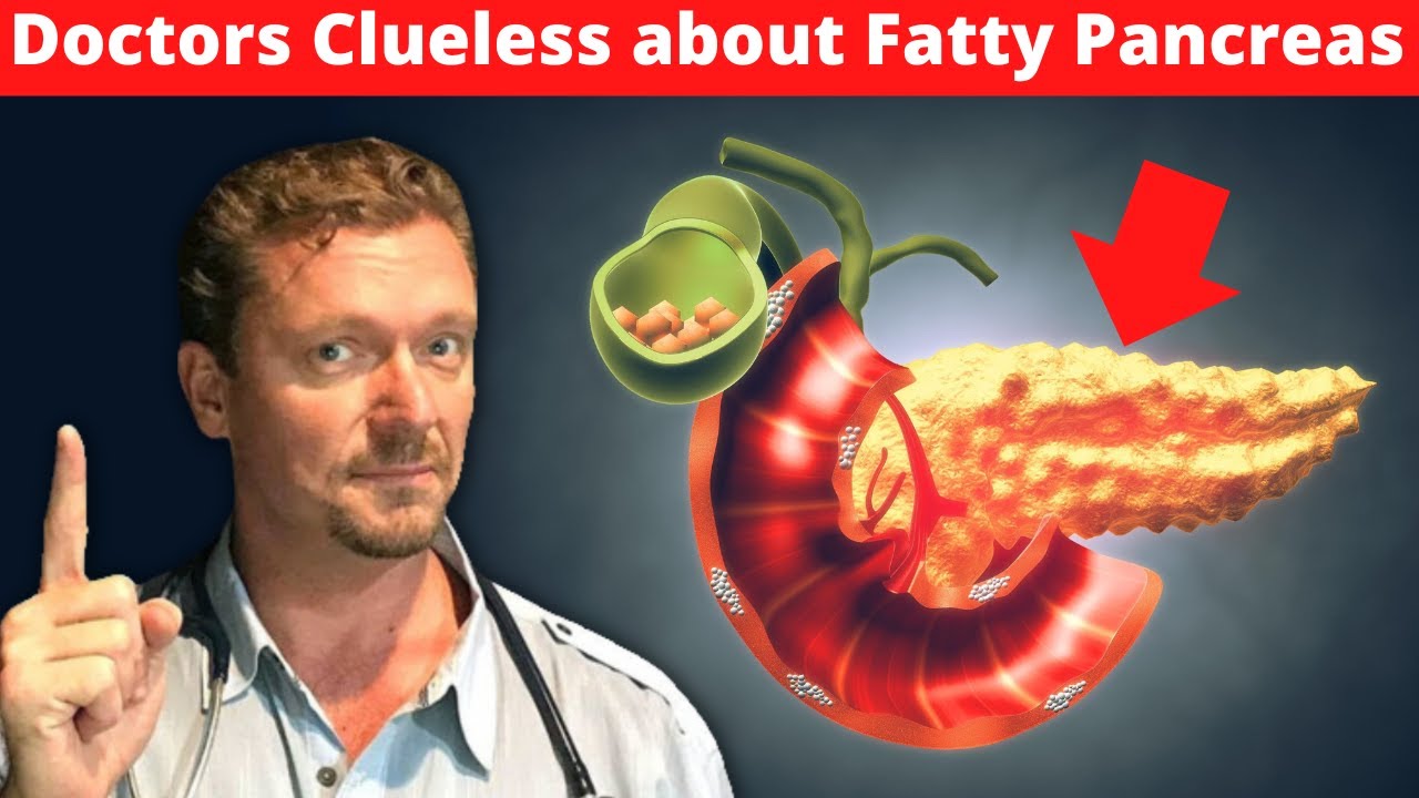 Doctors Clueless about Fatty Pancreas [Worse than Fatty Liver] 2024