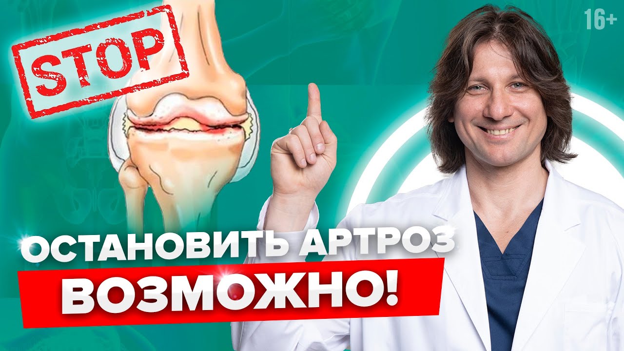 Как не довести до операции при артрозе? Как лечить артроз.