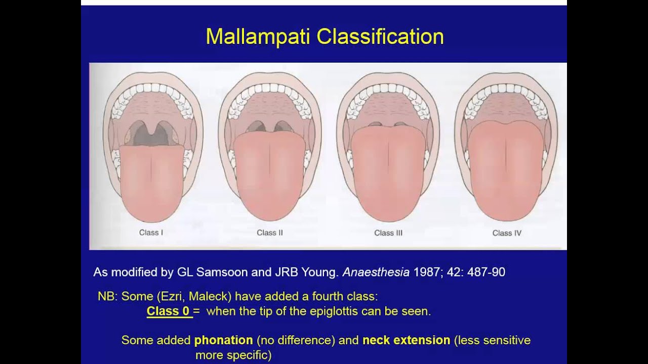 20150817 Preparation and Mgmt Known Difficult Airway