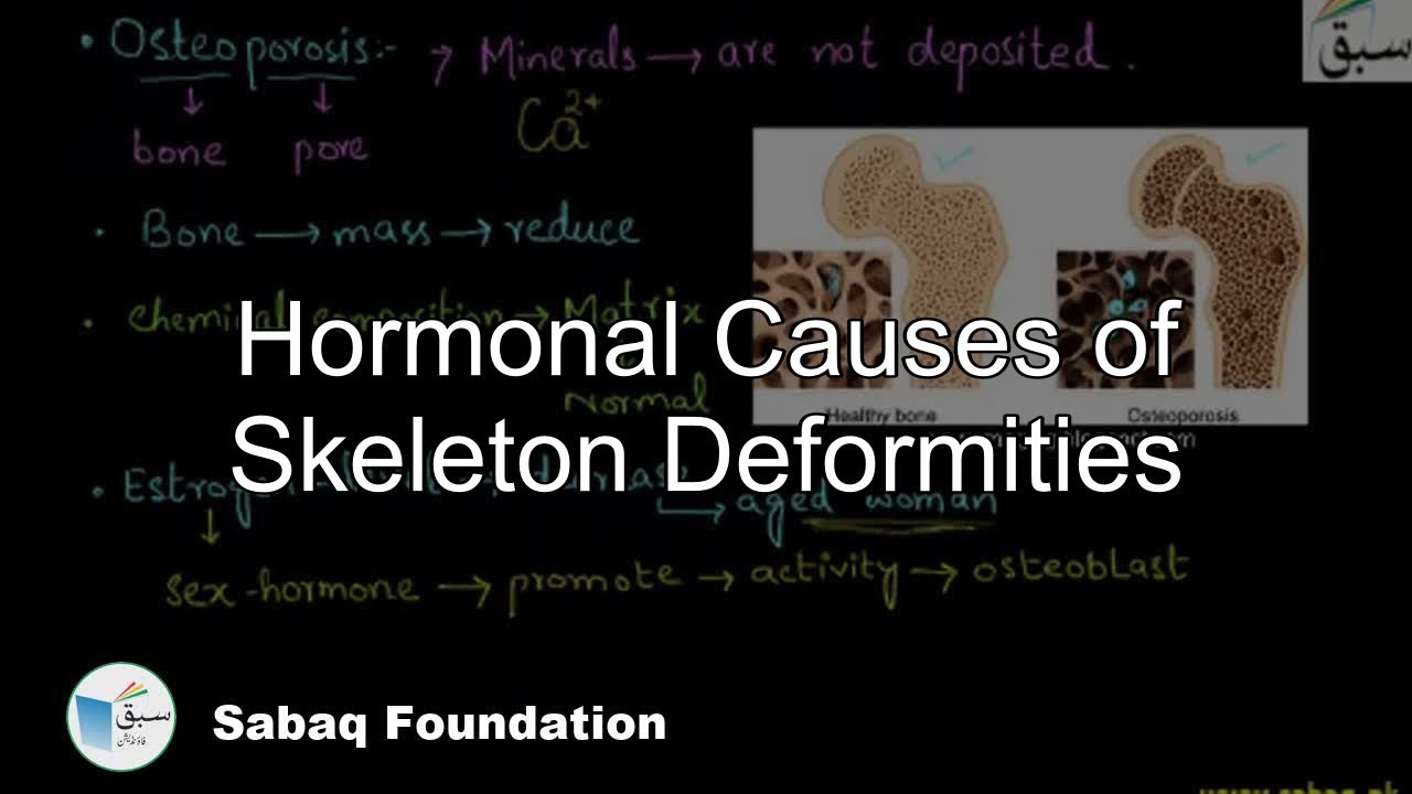 Hormonal Causes of Skeleton Deformities, Biology Lecture | Sabaq.pk