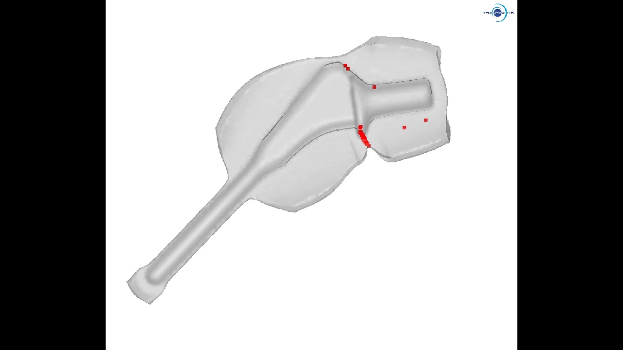 Closed-die forging simulation of a femoral implant with folds detection - FORGE&reg;