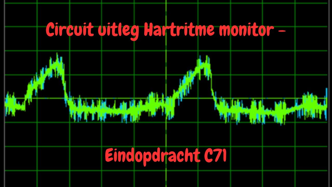 Circuit uitleg Hartritme monitor - Eindopdracht C71