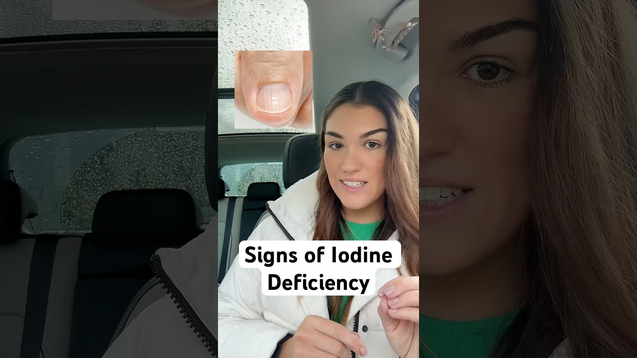 4 Signs of Iodine Deficiency You Shouldn&rsquo;t Ignore