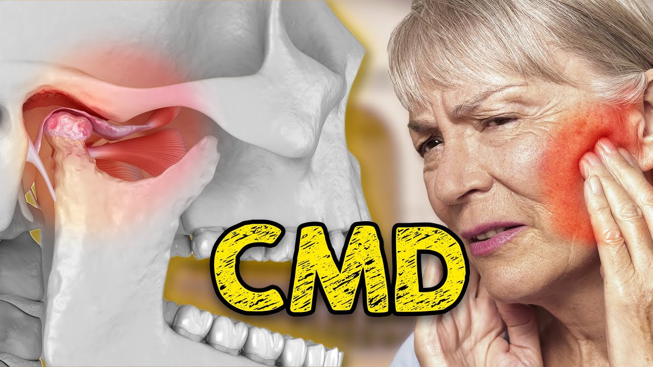 CMD: Teure, schmerzhafte Irrtümer bei Kieferproblemen - Irrationale Therapie oder natürliche Lösung?