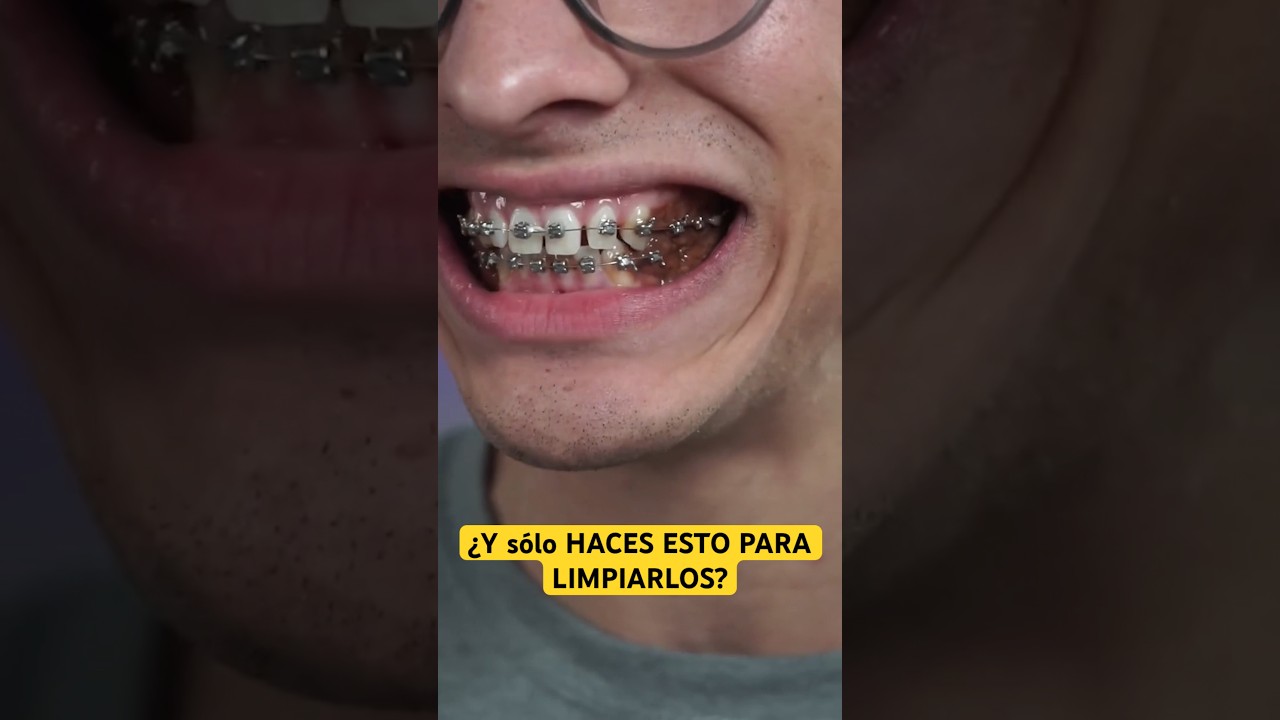 Si quieres limpiar tus brackets y SOLO HACES ESTO f&iacute;jate en el resultado
