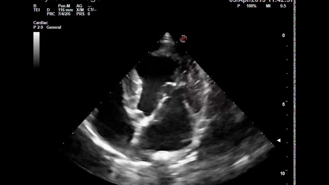esaVET MyLab Omega MVD stage B1 in dog