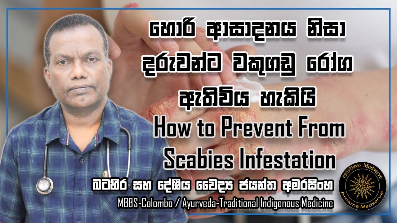 හොරි ආසාදනය නිසා දරුවන්ට වකුගඩු රෝග ඇතිවිය හැකියි | How to Prevent From Scabies Infestation