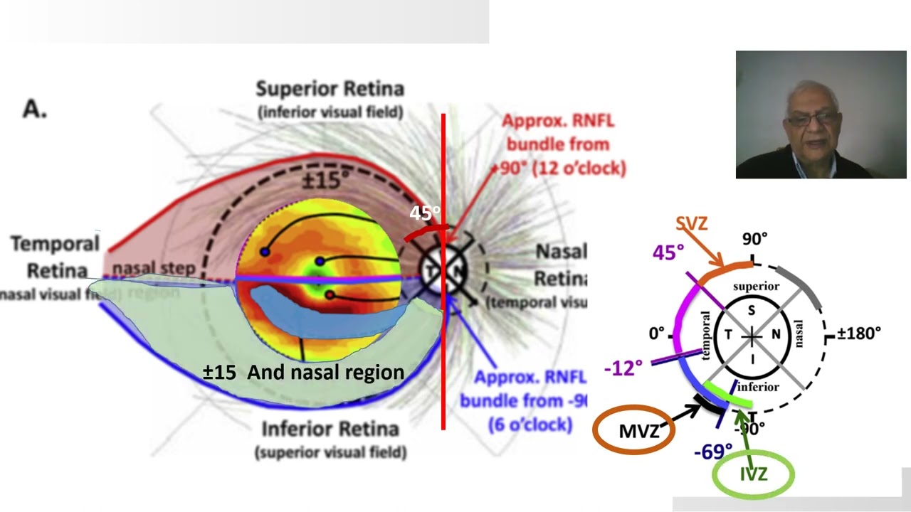 Hood et al  model of glaucoma damage