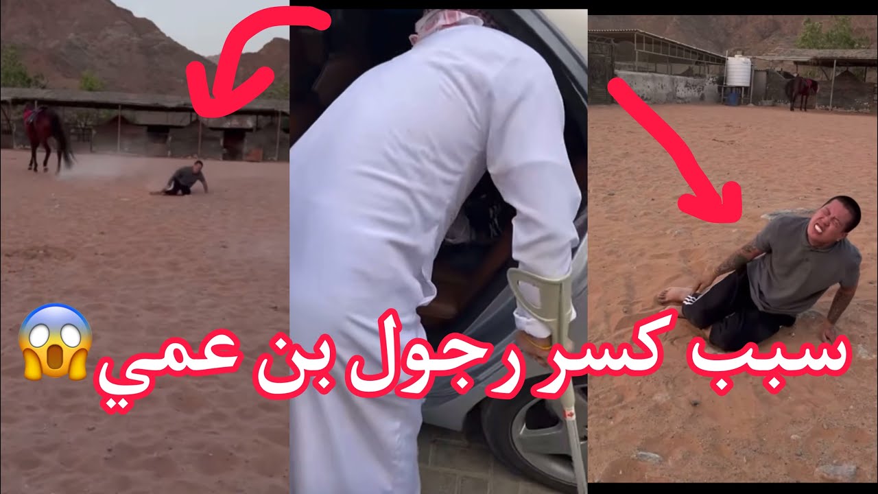 سبب كسر رجل بن عمي😱