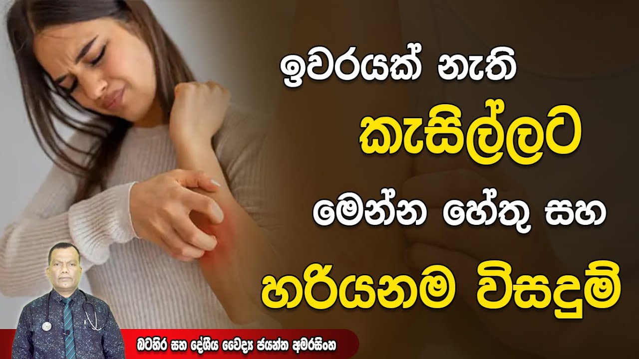 ඉවරයක් නැති ඇග කැසිල්ලට මෙන්න හේතු සහ හරියනම විසදුම් | Itching | Pruritus
