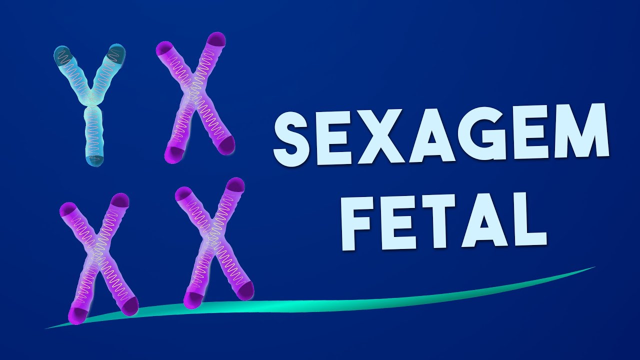 SEXAGEM FETAL: É menino ou menina? É confiável? Saiba Tudo Sobre o Exame