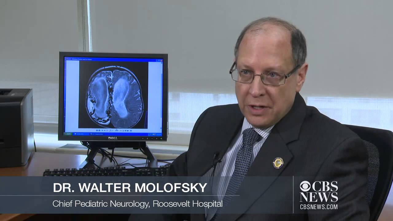 Doctors perform non-invasive brain surgery on toddler
