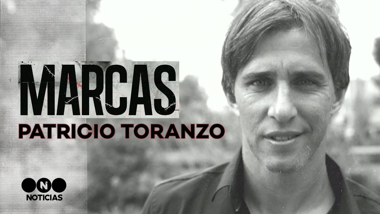 MARCAS: PATRICIO TORANZO, el ÚNICO JUGADOR de FÚTBOL con 6 DEDOS - Telefe Noticias