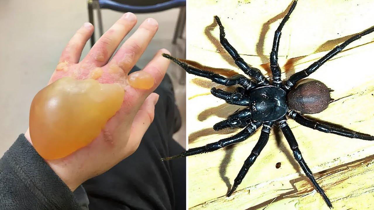 AS 9 ARANHAS MAIS PERIGOSAS DO MUNDO