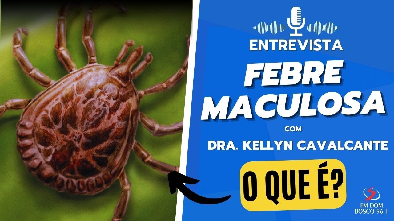 Dra. KELLYN CAVALCANTE FALA TUDO SOBRE FEBRE MACULOSA, TRANSMISSÃO,  SINTOMAS E TRATAMENTO
