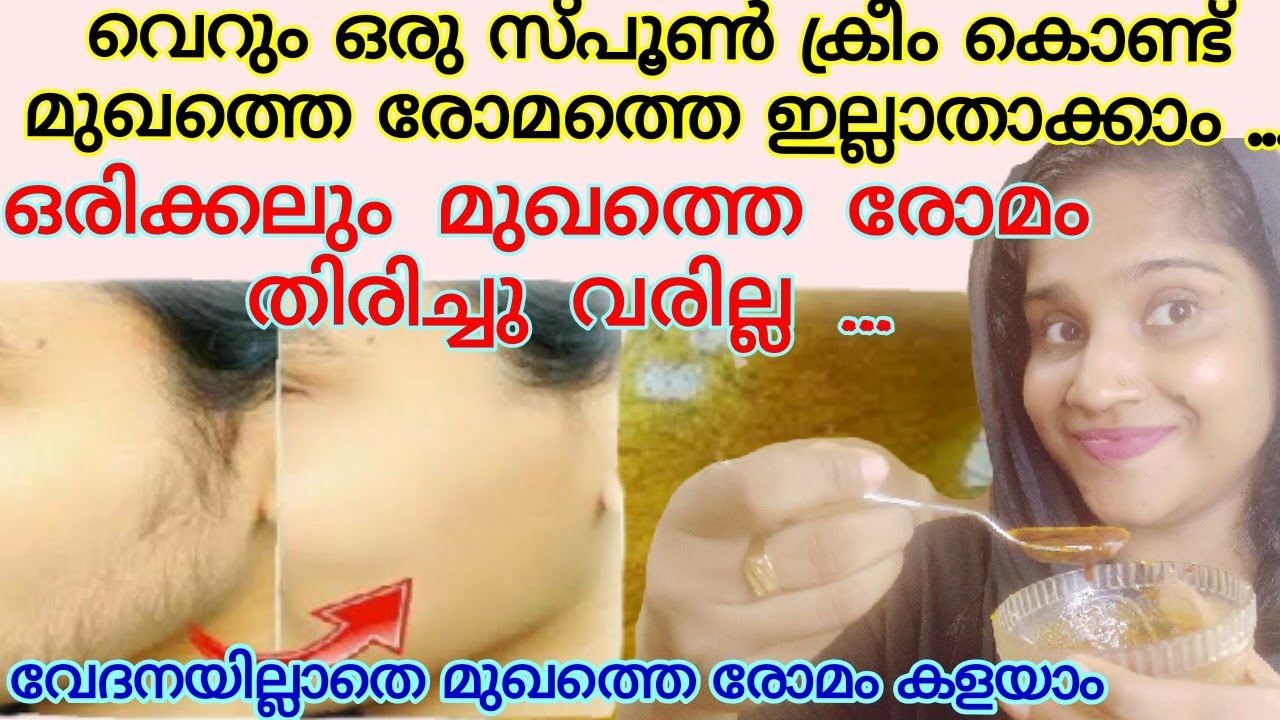 Live Result|Remove Facial Hair At Home in 10 Minutes|അമിത രോമവളർച്ച ഇല്ലാതാക്കാൻ|മുഖത്തെ രോമം കളയാം