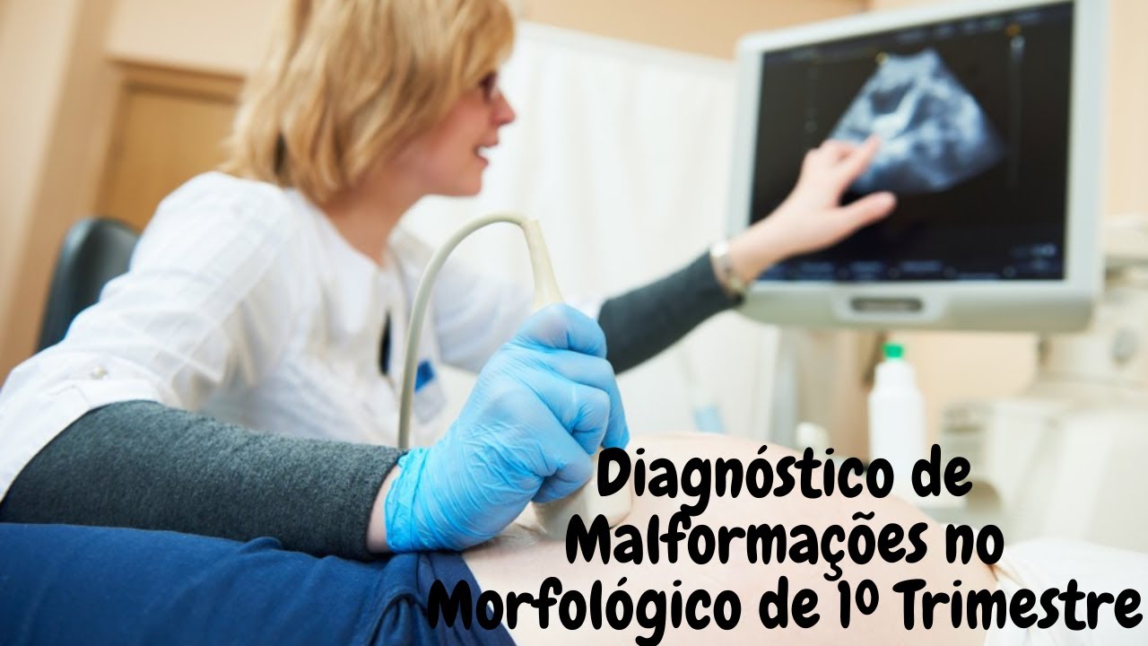 DIAGN&Oacute;STICO DE MALFORMA&Ccedil;&Otilde;ES NO 1&ordm; TRIMESTRE DA GESTA&Ccedil;&Atilde;O