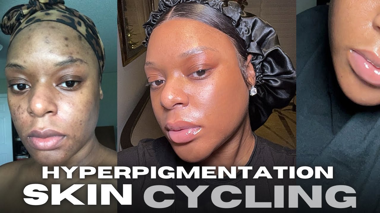 HOW TO CLEAR YOUR HYPERPIGMENTATION WITH SKIN CYCLING
