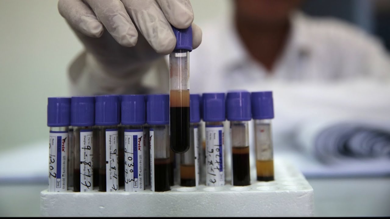 VERIFY: Are people with Type O blood less susceptible to COVID-19?