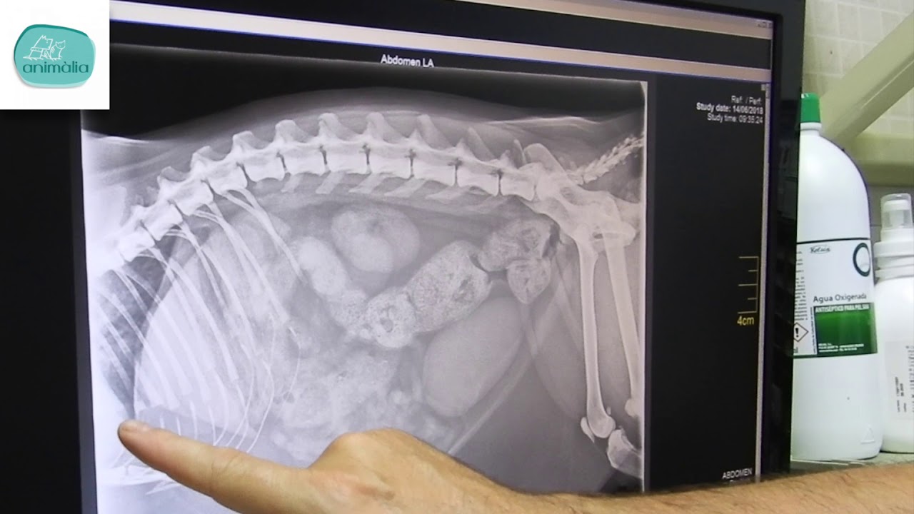 ¿Cómo se interpreta una radiografía?