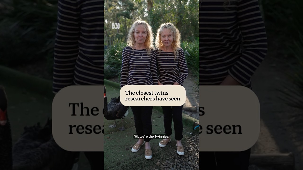 The closest twins researchers have seen | Australian Story