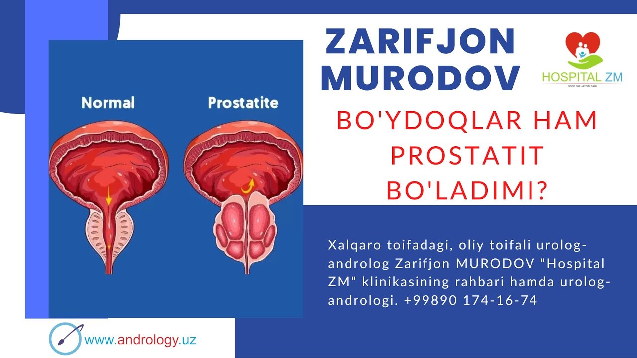 Bo'ydoqlar (yoshlar) ham prostatit bo'ladimi?