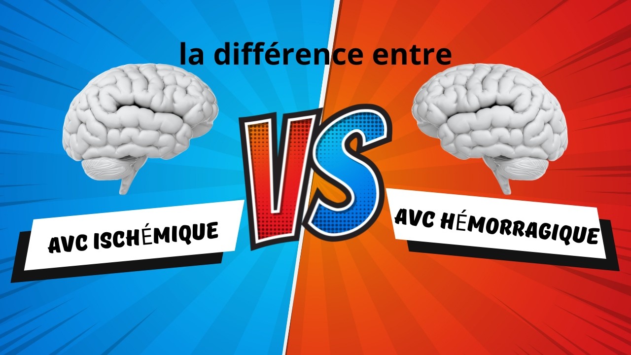 La différence entre un AVC ischémique et un AVC hémorragique