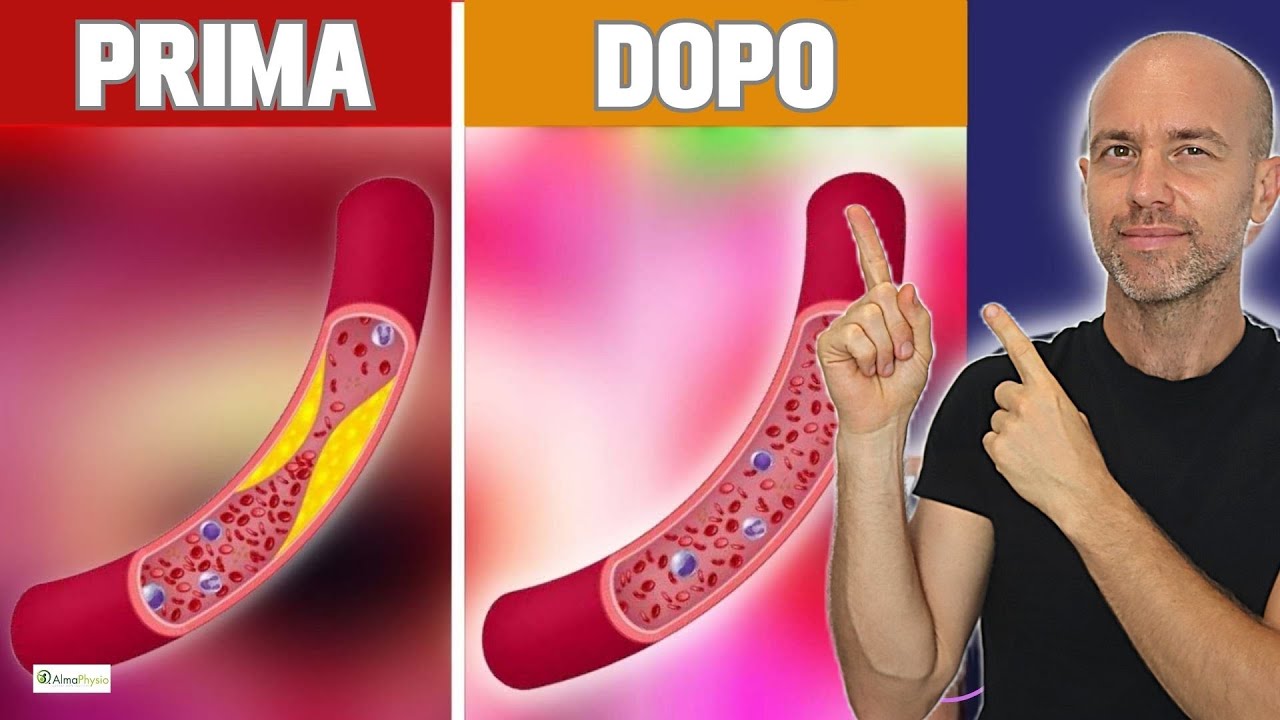 IL MIGLIOR ALIMENTO PER PULIRE LE TUE ARTERIE