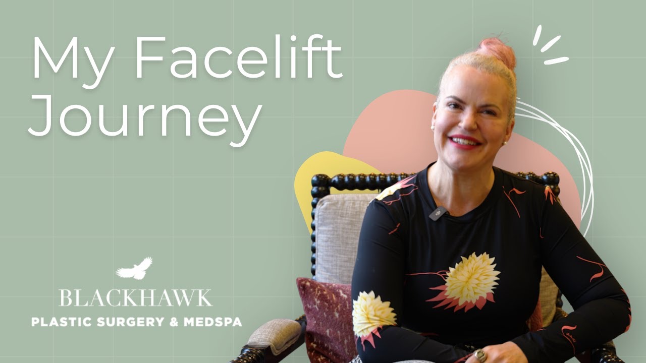 Real Facelift Story & Before/After Transformation