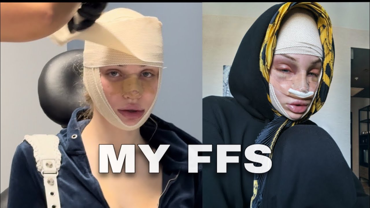 MY FFS | Adea
