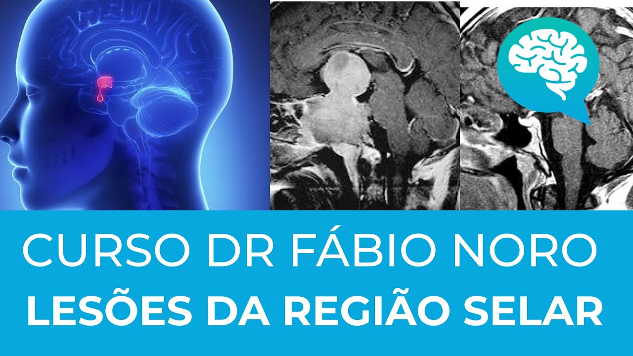 LESÕES DA REGIÃO SELAR | CURSO | DR FABIO NORO