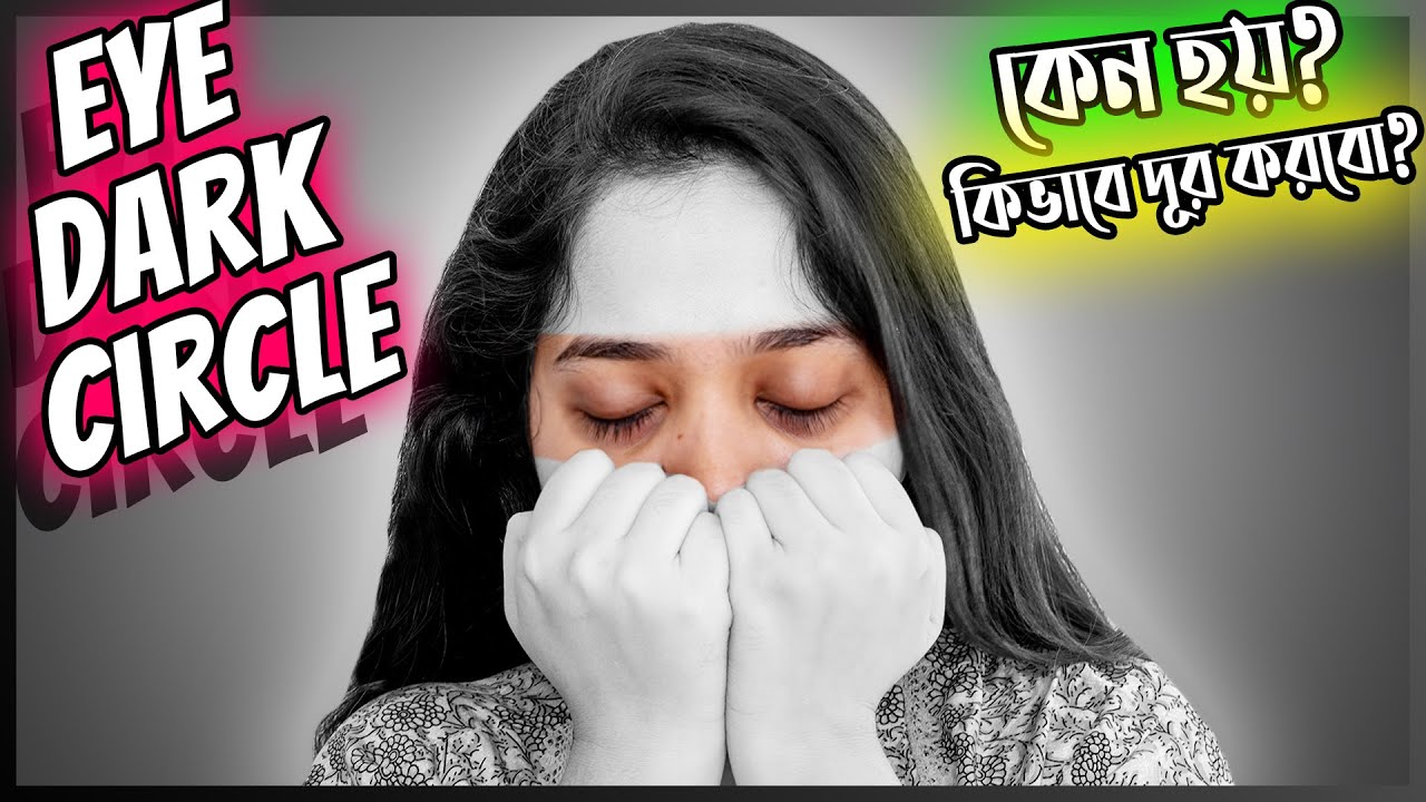 আই ডার্ক সার্কেল কেন হয়? চোখের নিচের কালো দাগ কিভাবে দূর করবো?  How To Get Rid of Eye Dark Circles?