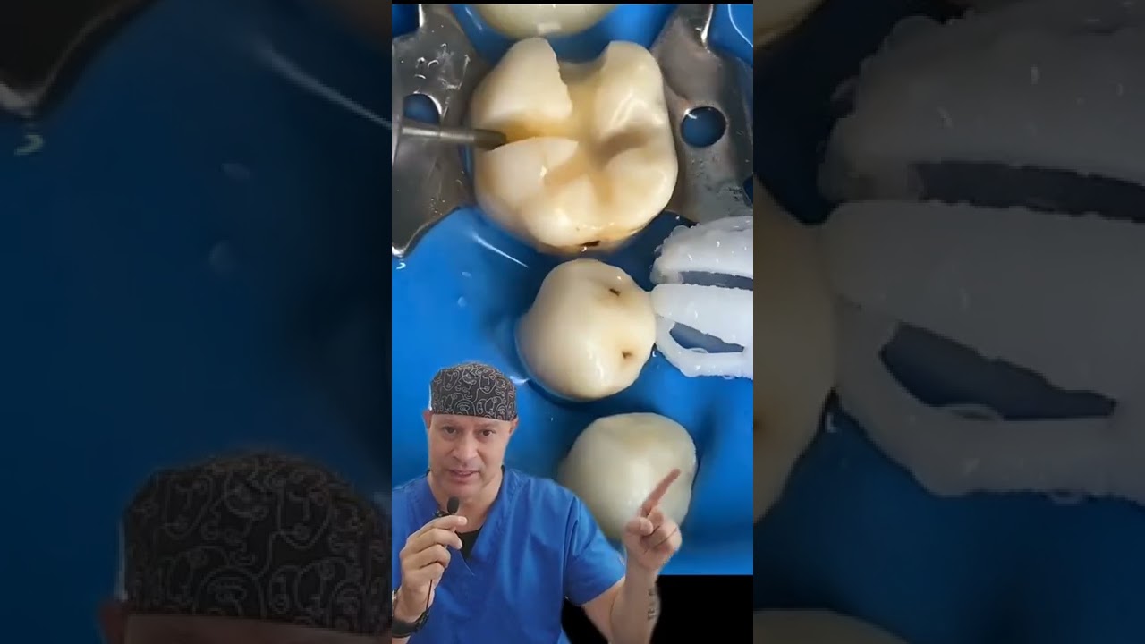 Caries y Aislado con dique de hule #shorts #dentista