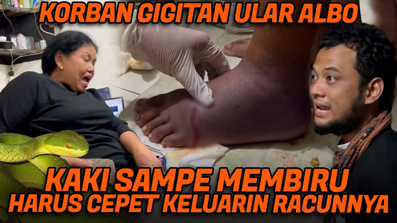 DIGIGIT ULAR VIPER POHON KAKI IBU INI BENGKAK MEMBIRU! TERIAK KESAKITAN SAAT KAMI TOLONG