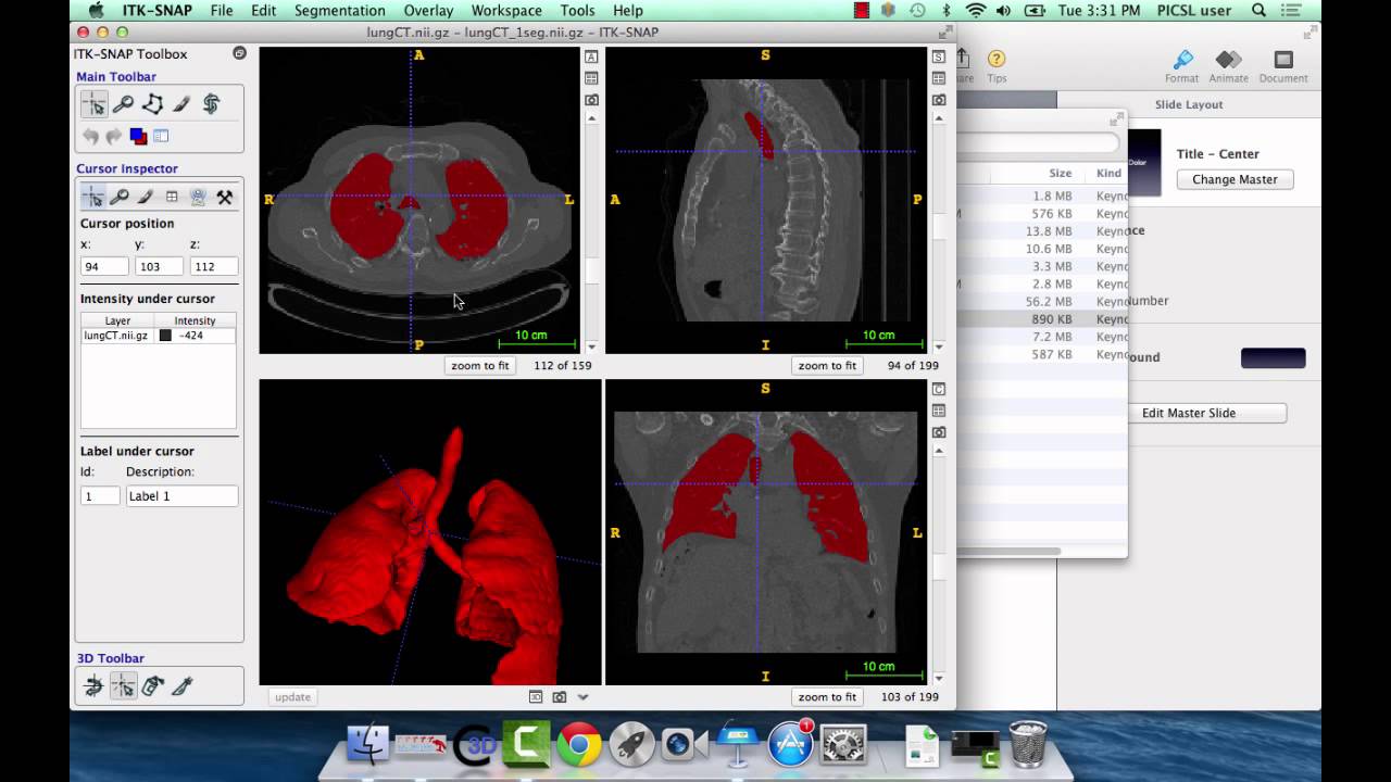 ITK-SNAP 3.2 User Training, Session 8: 3D Navigation and Editing