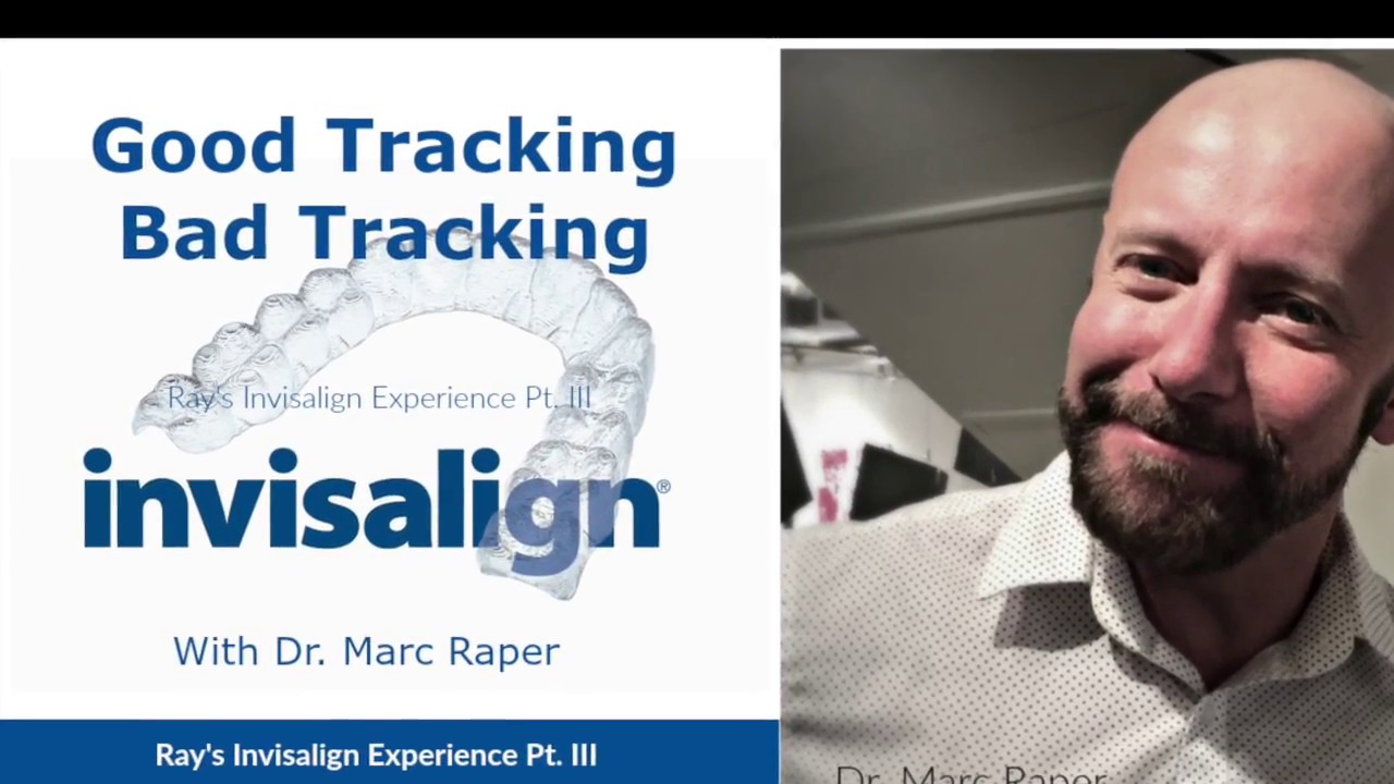 Invisalign Good Tracking and Bad Tracking - Pt 3 Ray's Invisalign Journey