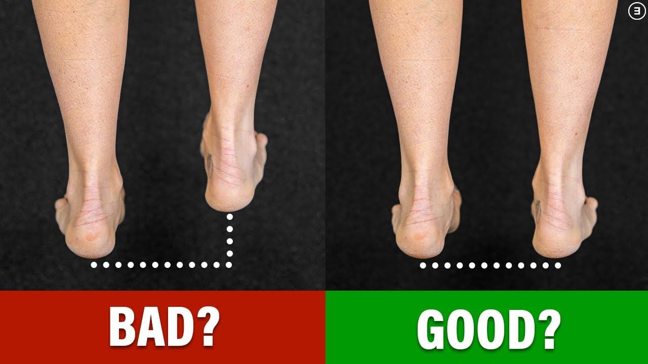 You DON’T Need to FIX Your Leg Length Difference!